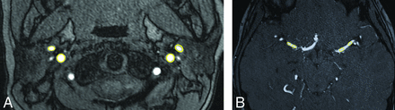 Fig 1.