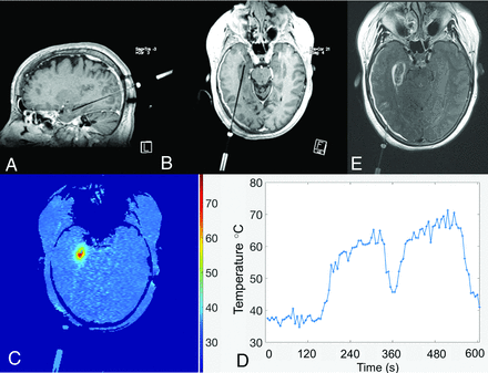 Fig 5.