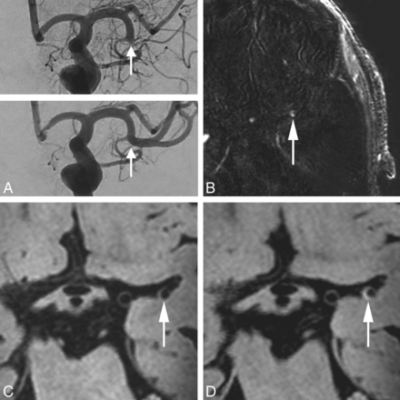 Fig 2.