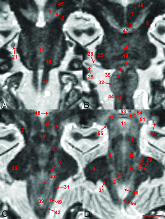 Fig 2.