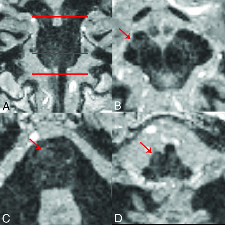 Fig 6.