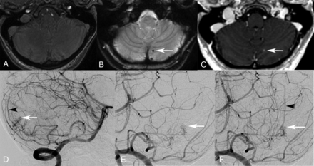 Fig 2.