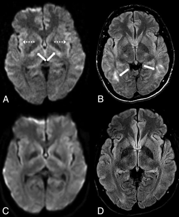 Fig 12.