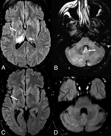 Fig 4.