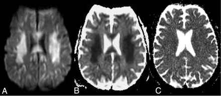 Fig 6.