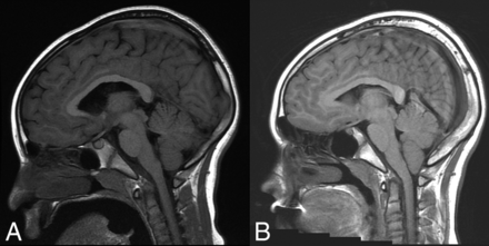 Fig 2.