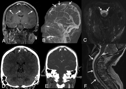 Fig 6.