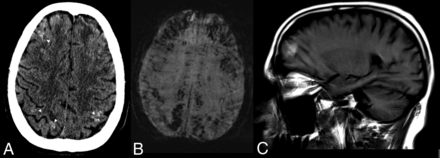 Fig 2.