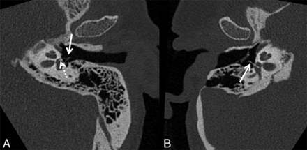 FIG 3.