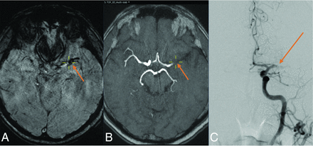 FIG 1.