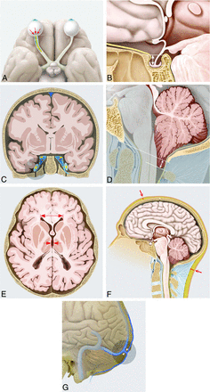 FIG 1.