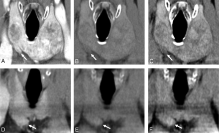 FIG 5.