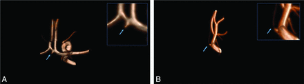 FIG 1.