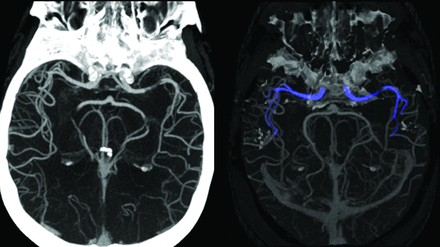 FIG 5.