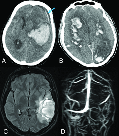 FIG 1.