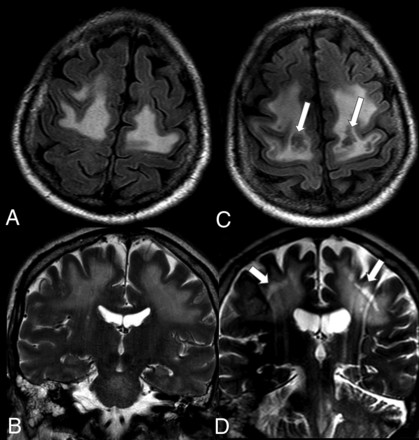 FIG 2.