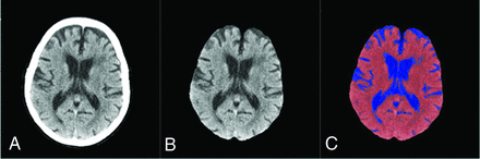 FIG 1.