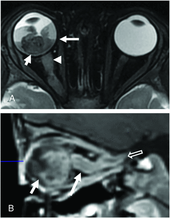 FIG 3.