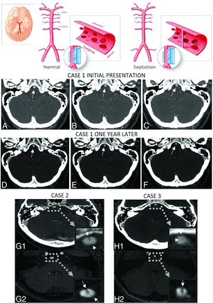 FIG 2.