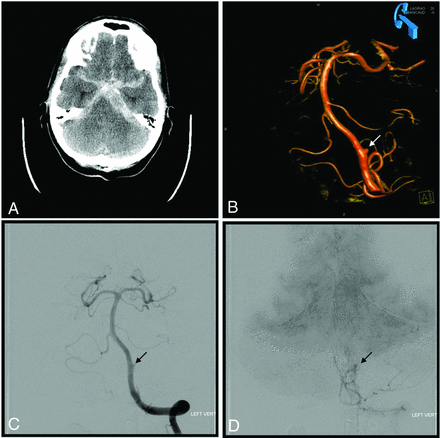 FIG 2.