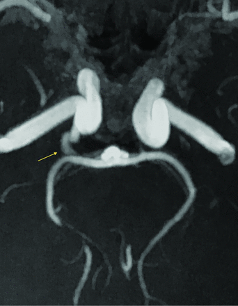 FIG 2.