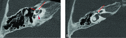 FIG 2.