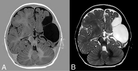 FIG 4.