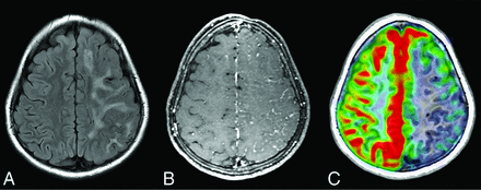 FIG 3.