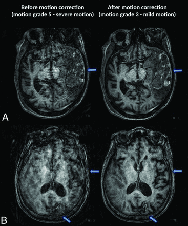 FIG 4.