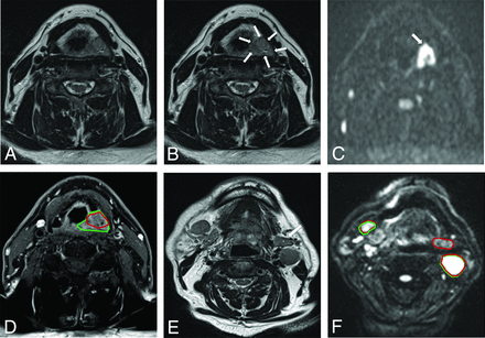 FIG 1.