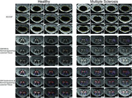 FIG 2.