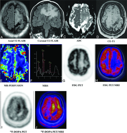 FIG 4.