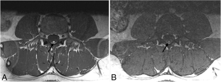 FIG 1.