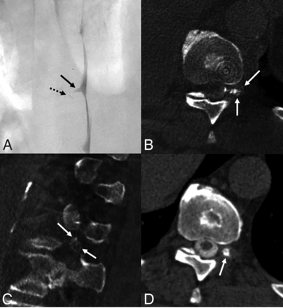 FIG 3.