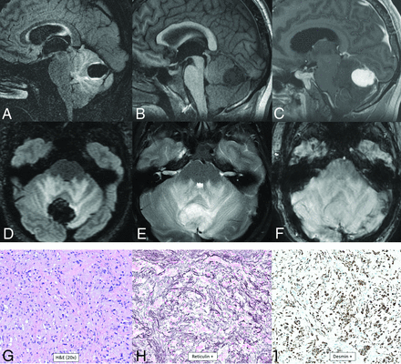 FIG 12.