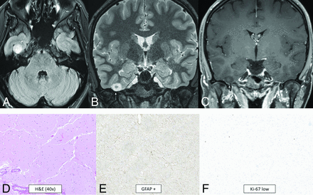 FIG 3.