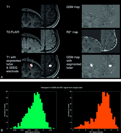 FIG 1.