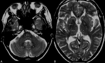 Fig 2.