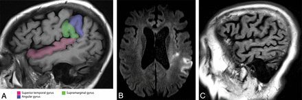 Fig 6.