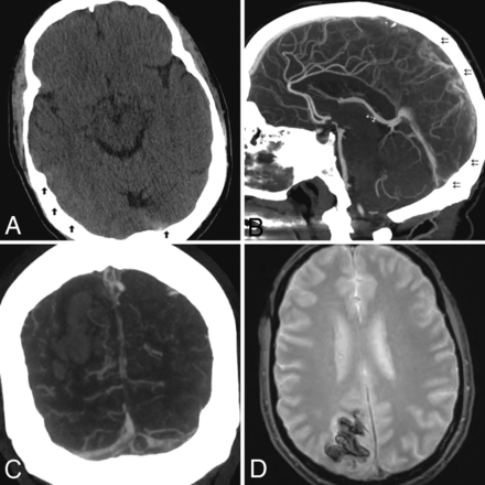 FIG 1.