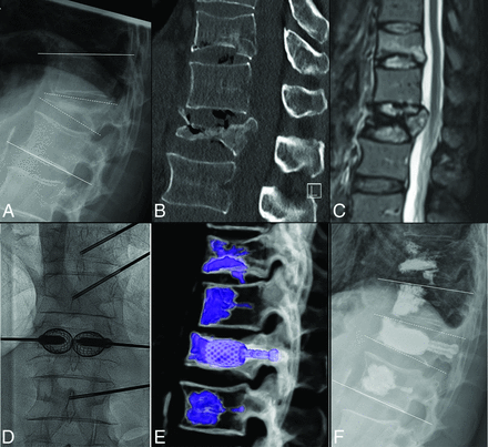 FIG 2.