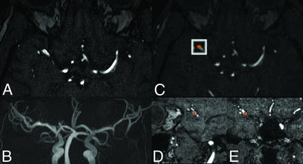 FIG 2.