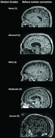 FIG 1.