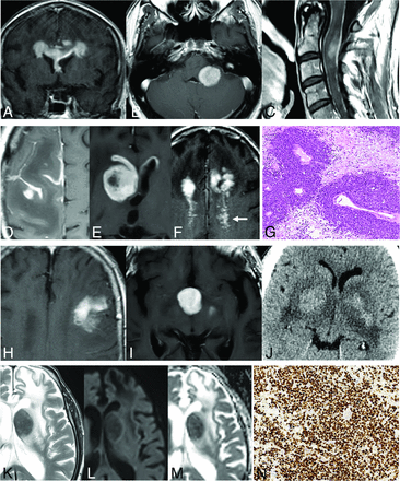 FIG 1.