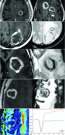 FIG 4.