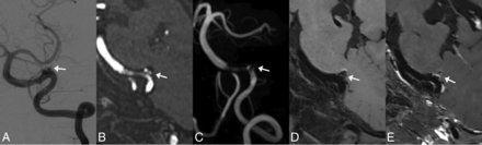 FIG 1.