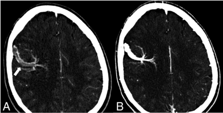 FIG 9.