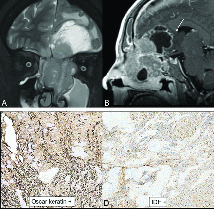 FIG 1.