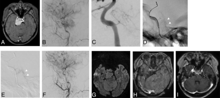 FIG 2.