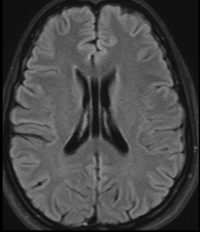 January 26, 2017 - Case of the Week | American Journal of Neuroradiology